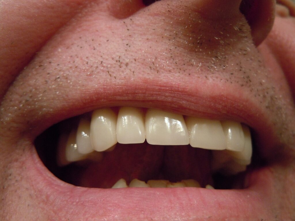 Estética dental Casco