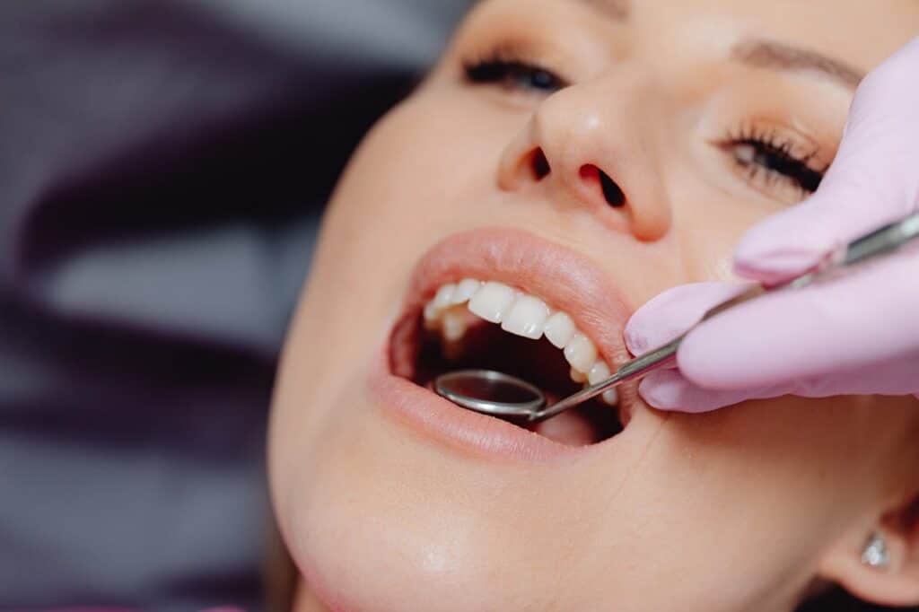 Estética dental San Juan de Mozarrifar